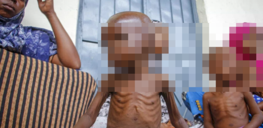 UNICEF alerta que 3.7 millones de niños en Afganistán están en riesgo de desnutrición