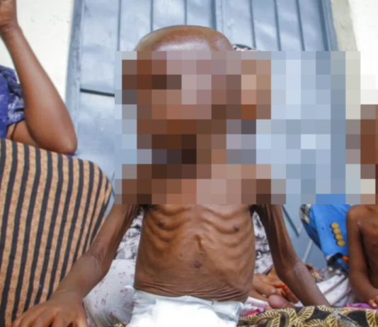 UNICEF alerta que 3.7 millones de niños en Afganistán están en riesgo de desnutrición