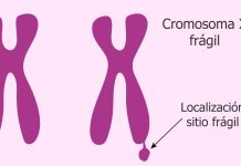 ¿Qué es el Síndrome del Cromosoma Frágil? Lo que debes saber sobre esta condición