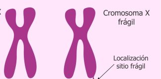 ¿Qué es el Síndrome del Cromosoma Frágil? Lo que debes saber sobre esta condición