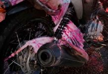 Trágico accidente en Tlajomulco: Niña de 4 años pierde un brazo al viajar en motocicleta