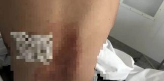 Veterano ruso sobrevive al impacto de un rayo al pelear contra oso; así sobrevivió
