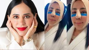 #VIDEO // Sandra Cuevas reaparece con férula en el rostro tras someterse a cirugía estética y funcional en la nariz