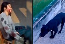 #VIDEO // Perro en situación de calle ataca a una mujer en Puebla y la deja con lesiones de gravedad