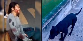#VIDEO // Perro en situación de calle ataca a una mujer en Puebla y la deja con lesiones de gravedad