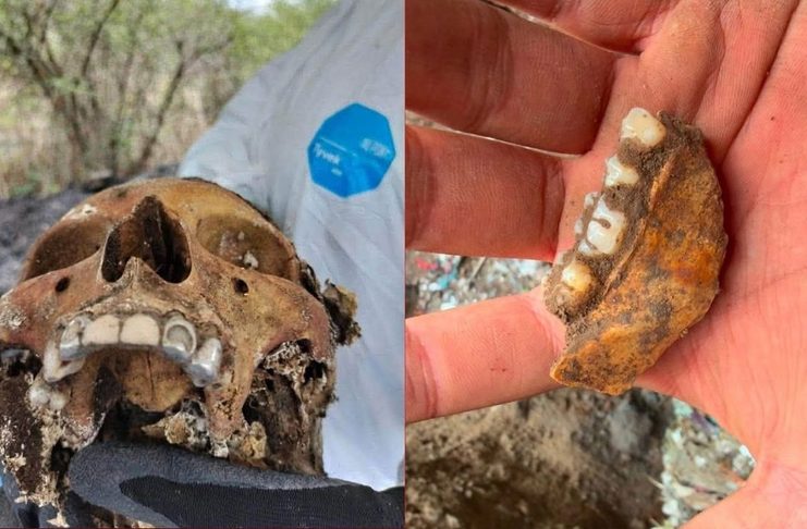 ¿A cuántas víctimas corresponden 1 mil 600 dientes de leche? Estas son algunas de las hipótesis forenses que podría explicarlo