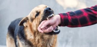 ¿Te mordió un perro? Esto es lo primero que debes hacer