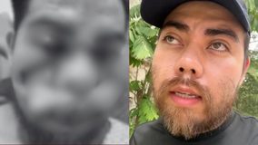 #VIDEO //”Casi muero”: artista y activista exige justicias tras haber sido brutalmente golpeado por rescatar animales
