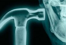 Bone smashing: la peligrosa moda de golpearse la cara con un martillo Joven sosteniendo un martillo cerca de su rostro, en referencia a la peligrosa tendencia viral del bone smashing.