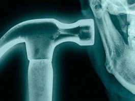 Bone smashing: la peligrosa moda de golpearse la cara con un martillo Joven sosteniendo un martillo cerca de su rostro, en referencia a la peligrosa tendencia viral del bone smashing.