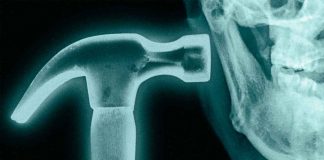Bone smashing: la peligrosa moda de golpearse la cara con un martillo Joven sosteniendo un martillo cerca de su rostro, en referencia a la peligrosa tendencia viral del bone smashing.