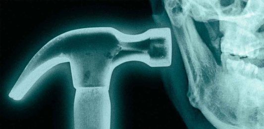 Bone smashing: la peligrosa moda de golpearse la cara con un martillo Joven sosteniendo un martillo cerca de su rostro, en referencia a la peligrosa tendencia viral del bone smashing.