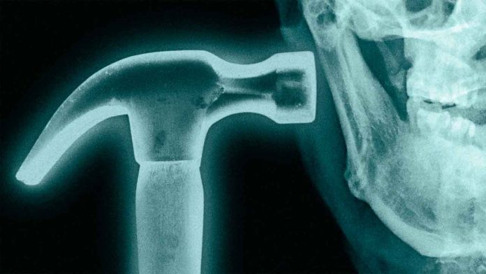 Joven sosteniendo un martillo cerca de su rostro, en referencia a la peligrosa tendencia viral del bone smashing.