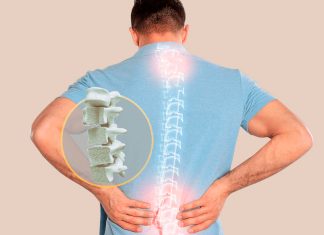 Día Mundial de la Osteoporosis: ¿cómo cuidar tus huesos y prevenir complicaciones?